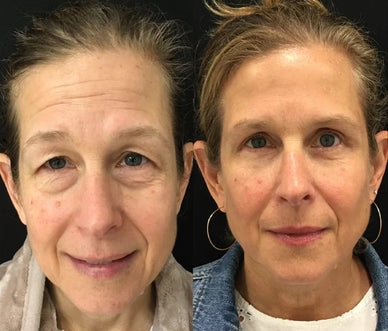 "Reveal Vibrant, Youthful Eyes Every Day"